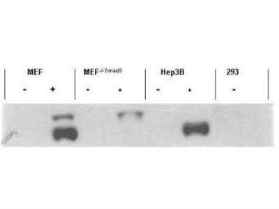 Western Blot: Smad3 [p Ser423, p Ser425] Antibody [NBP1-77836]